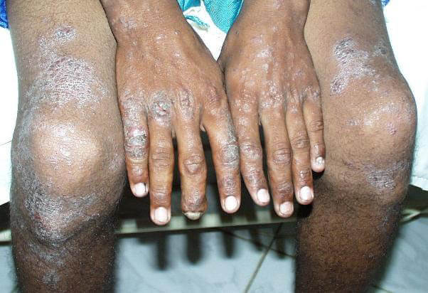 riscos do trabalho com cimento para pedreiros e construtores