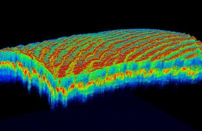 scanner retina