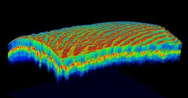 scanner retina