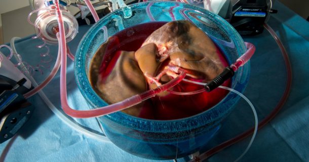 Supercongelamento permite preservar tecido humano por mais tempo e pode facilitar a doação de órgãos
