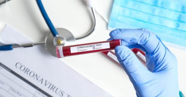 exemplo teste de coronavirus pode ser ampliado usando logica
