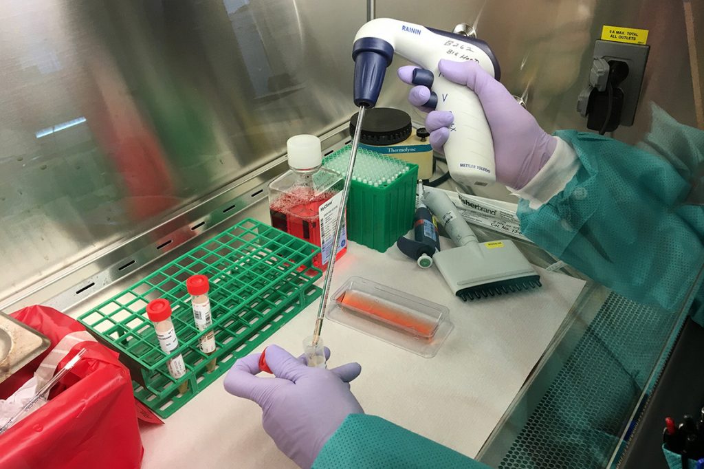 teste de coronavírus sendo feito em laboratório