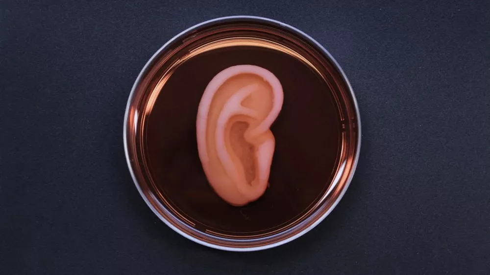 orelha impressa em 3D