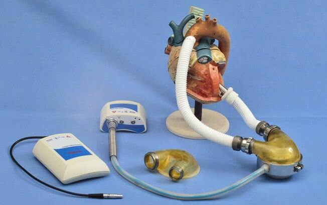 11 invenções brasileiras que tiveram impacto global e que talvez você não saiba invenções brasileiras