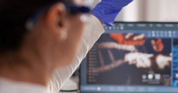 mulher-do-cientista-microbiologista-segurando-uma-fatia-com-amostra-de-sangue-durante-o-experimento-de-hematologia-trabalhando-no-laboratorio-bioquimico-de-um-hospital-medico-especialista-com-luva-medica-analisand