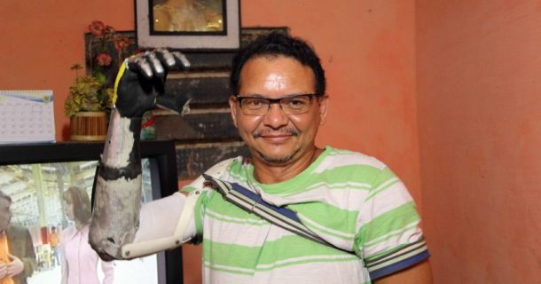 inventor que cria Próteses de sucatas