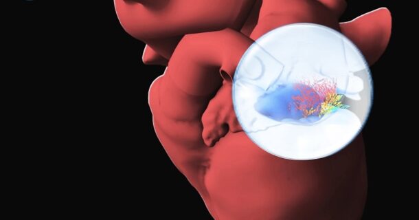 Descubra o impacto transformador do Projeto Living Heart na Medicina projeto Living Heart - 3DEXPERIENCE World 2025